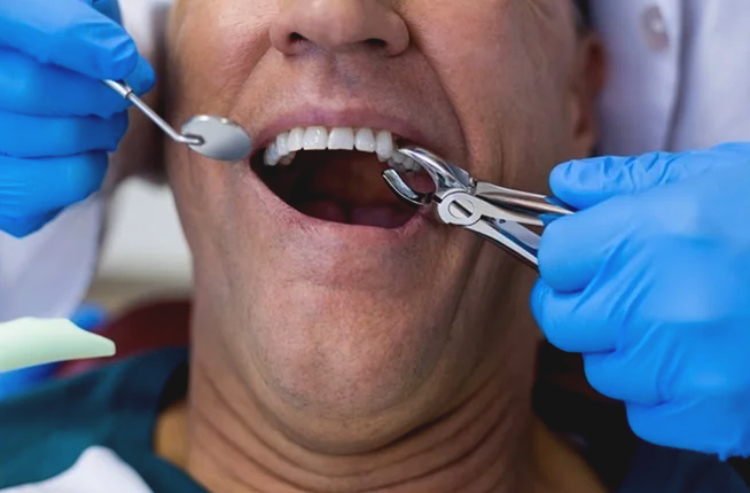 مراقبت‌ های بعد از جراحی دندان