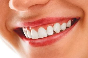 روش‌های بالا بردن استحکام دندان