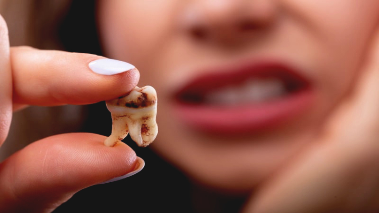 عوامل مؤثر در نکروز دندان 